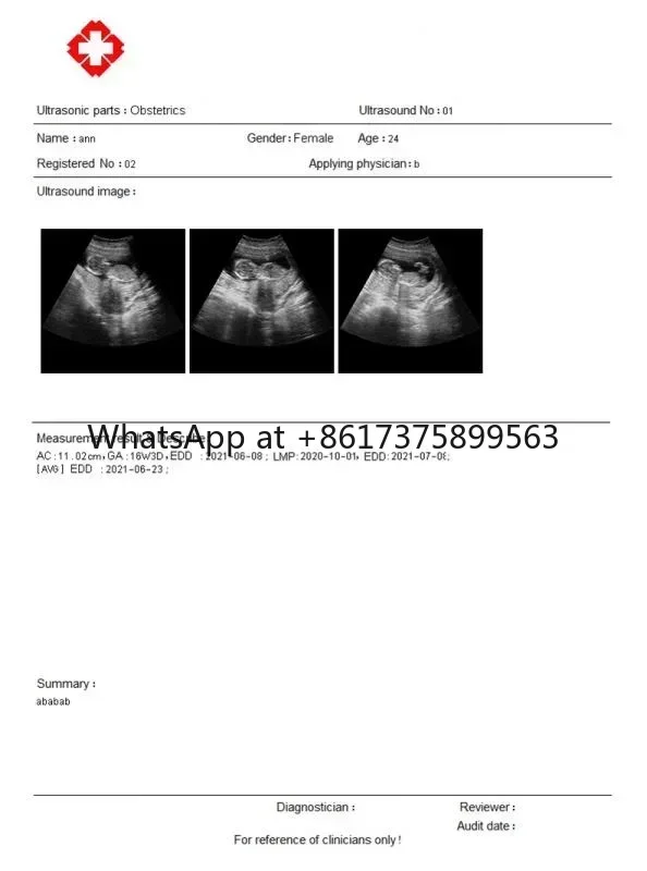 Диагностическая машина Новый 12-дюймовый светодиод