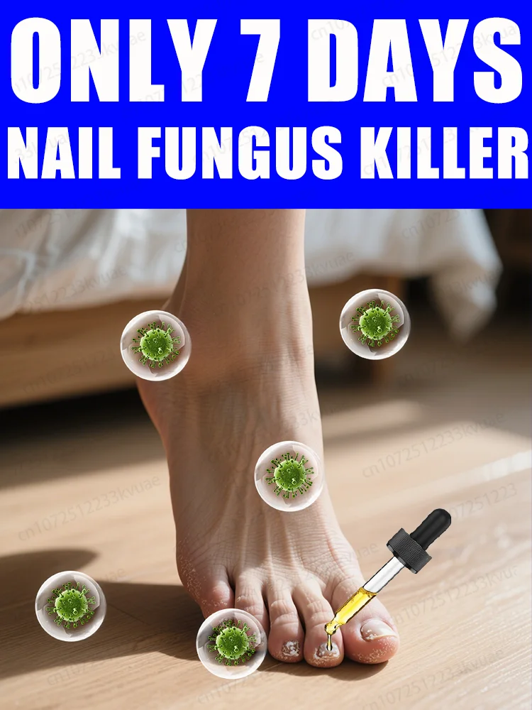 

ᴺᵃⁱˡ ᶠᵘⁿᵍᵘˢ ᵗʳᵉᵃᵗᵐᵉⁿᵗ ᵉˢˢᵉⁿᵗⁱᵃˡ ᵒⁱˡ⸴ ʳᵉᵖᵃⁱʳ ᵒⁿʸᶜʰᵒᵐʸᶜᵒˢⁱˢ ⁱⁿ ⁷ ᵈᵃʸˢ