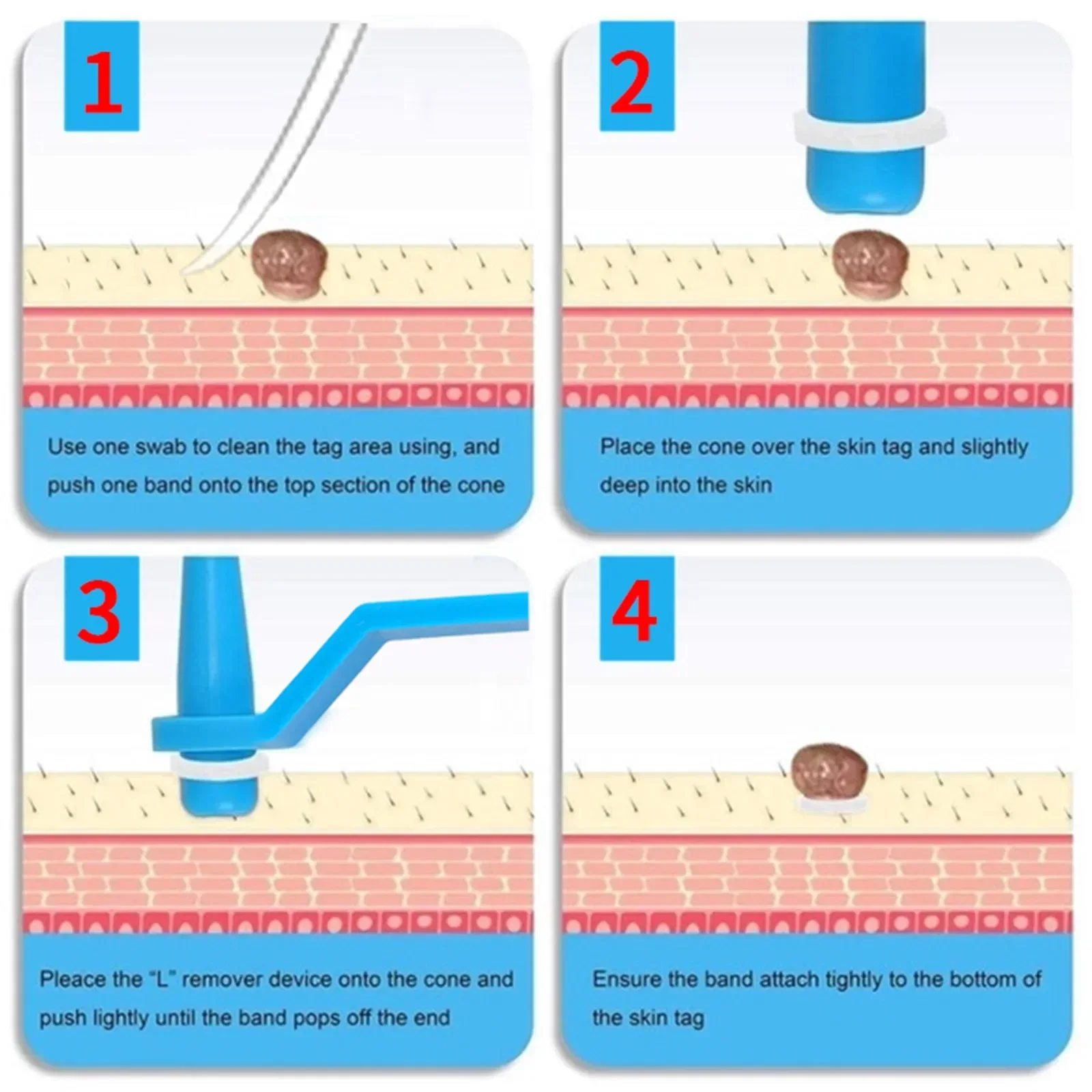 30 Pezzi Elastico per la rimozione Microstrip Non tossico Talpa Verruca Pelle Tag Rimozione Elastico Kit Uomo Donna Cura del viso Strumenti per la cura della pelle