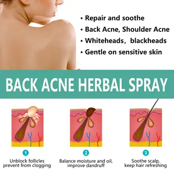 10 best sales Sırt sivilce spreyi - №2