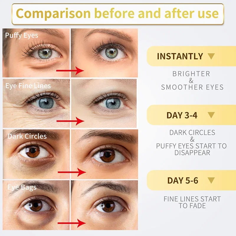 Crema de ojos para eliminar arrugas instantáneas, antienvejecimiento, elimina las ojeras, bolsas de ojos, hinchazón, desvanece las líneas finas, masajea el cuidado coreano