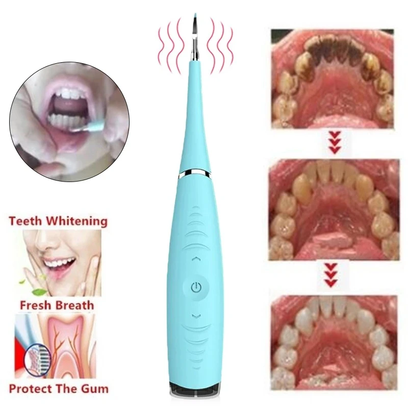 Christmas Gift Tooth Whitening Oral Care Cleaning Tool Portable Electric Water Flosser USB Rechargeable Tartar and Stain Remover