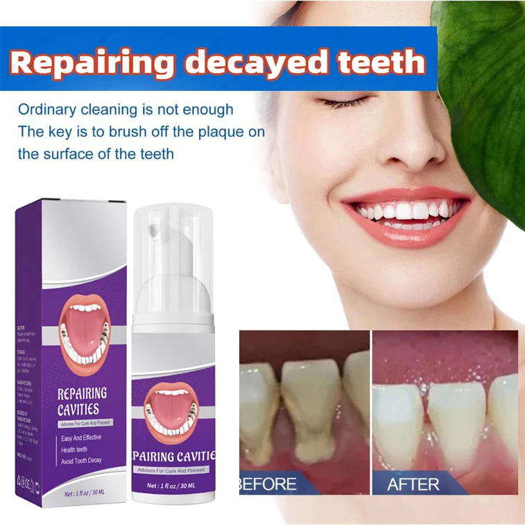 

Whitening Fresh Breath Brightening Purple Toothpaste Remove Stain Reduce Yellowing Care for Teeth Gums Oral Tooth Decay Repair