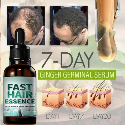 

Hair essential oil, say goodbye to baldness,. Secret Hair essence for Thick Hair