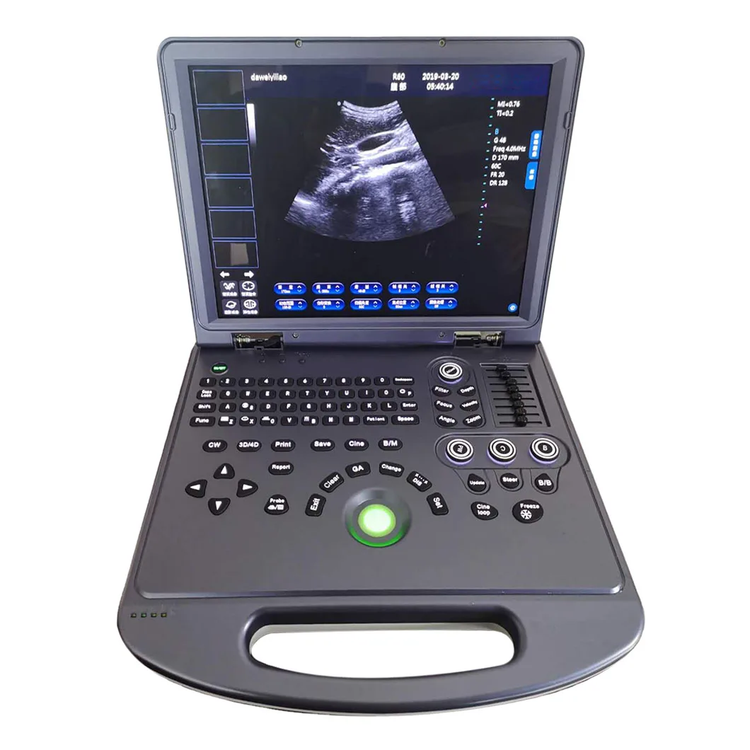 Vet Ultrasonic Diagnostic Instrument Animals Portable Veterinary Ultrasound Scanner for Pet hospital