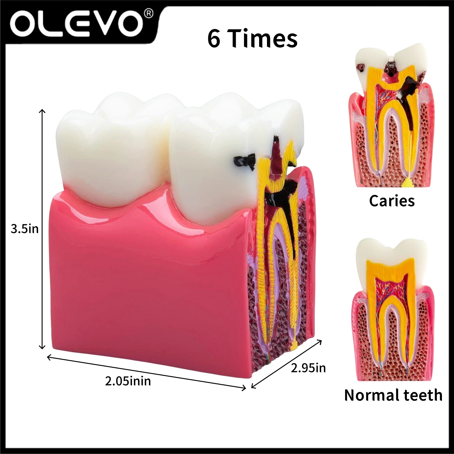 Model zębów dentystycznych 6-krotny próchnica badanie porównawcze Model próchnicy zębów Model demonstracyjny protezy Model szkolenia anatomii