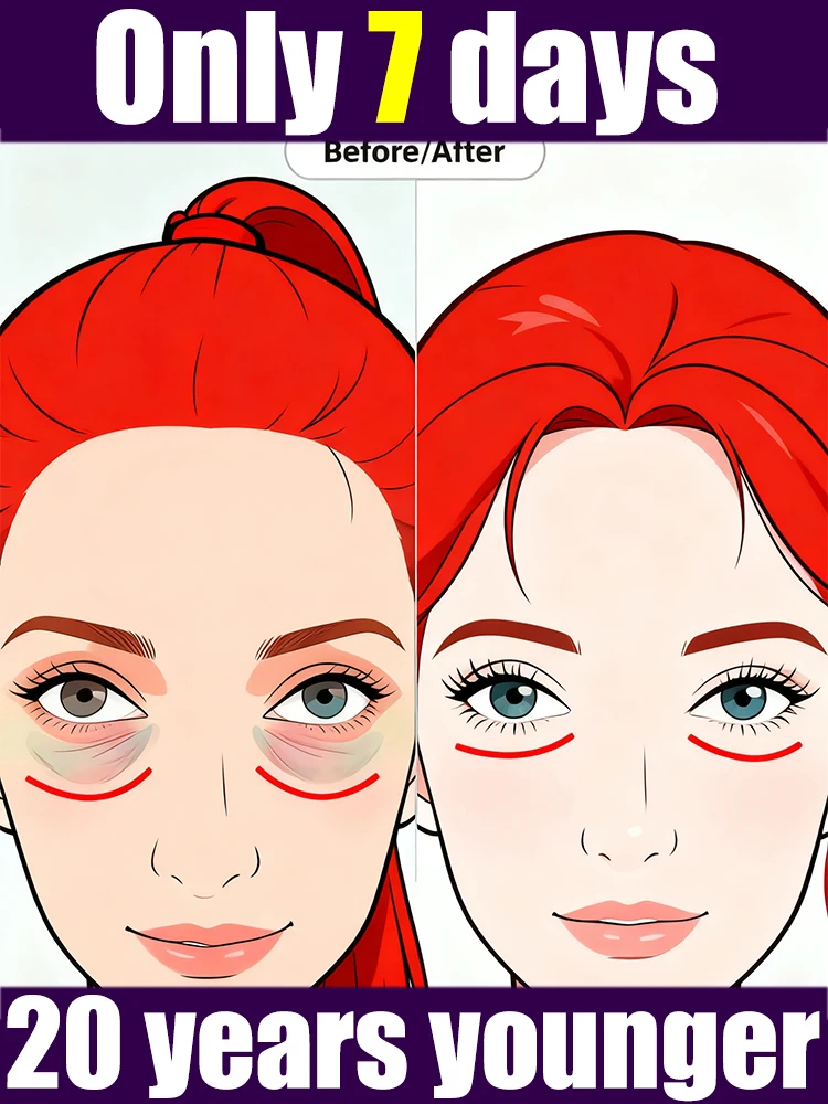 Generatie-2 gel zegt vaarwel tegen je onroerend in 7 dagen