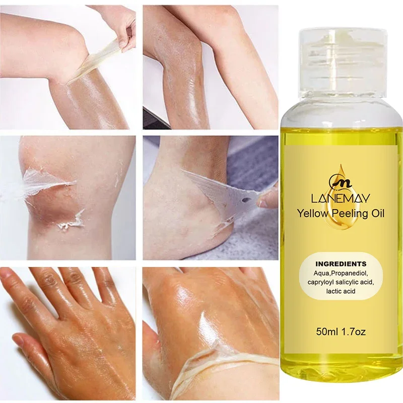 Minyak pengelupas kuning Serum kulit gelap, penghilang lengan lutut kaki Melanin Serum pemutih badan mencerahkan Scrub pengelupas kulit Korea mati Perawatan Kulit