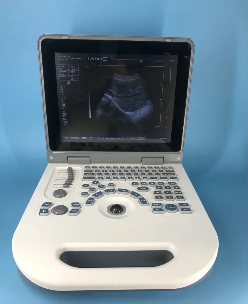 JM-806G Portable Ultrasound Scanner Medical Ultrasound Instruments Famous brand Sunbright Bw Ultrasound Machine