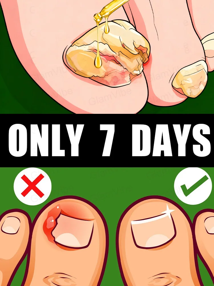 การดูแลเล็บอย่างง่ายเพื่อให้เล็บของคุณสะอาดและเรียบร้อย