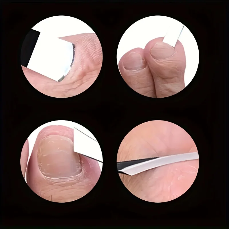 Set per la cura dei piedi in acciaio inossidabile da 2/6 pezzi, coltello esfoliante affilato e raschietto liscio per i piedi, tagliaunghie incarnite, rimozione della pelle morta