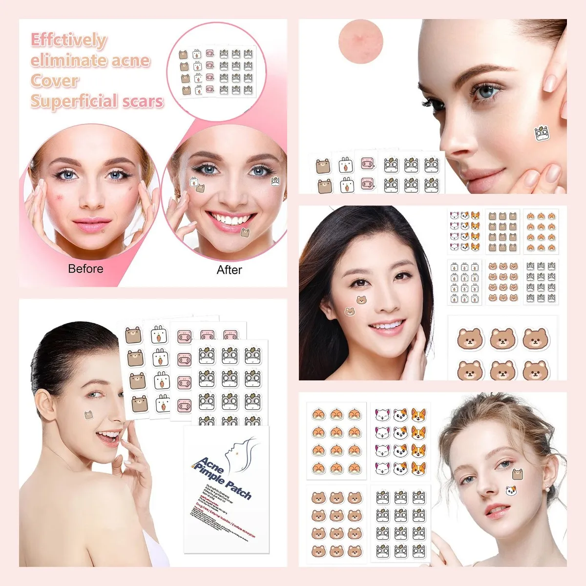 60pcs Cute Cartoon Cow Acnes Care Patch Pimple Spots Treatment Gentle Breathable Soothing Invisible Facial Care Sticker