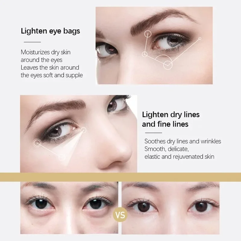 Crème anti-vieillissement pour les yeux, multi-effets, déformable, élimination des poches sous les yeux, resserre les poches, estompe les ridules, soins de la peau, beauté