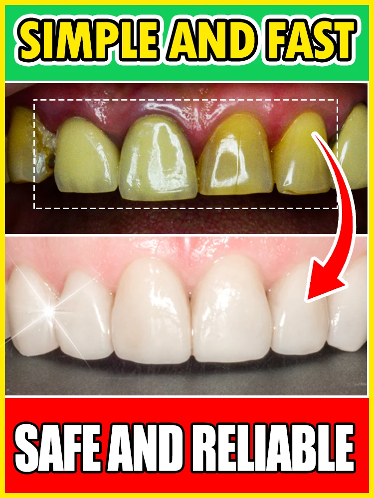 

Teeth Whitening Remove Tooth Stains Tartar Prevent Pigmentation Bleach Cleaning Odor Fresh Breath Oral Hygiene Care Tools