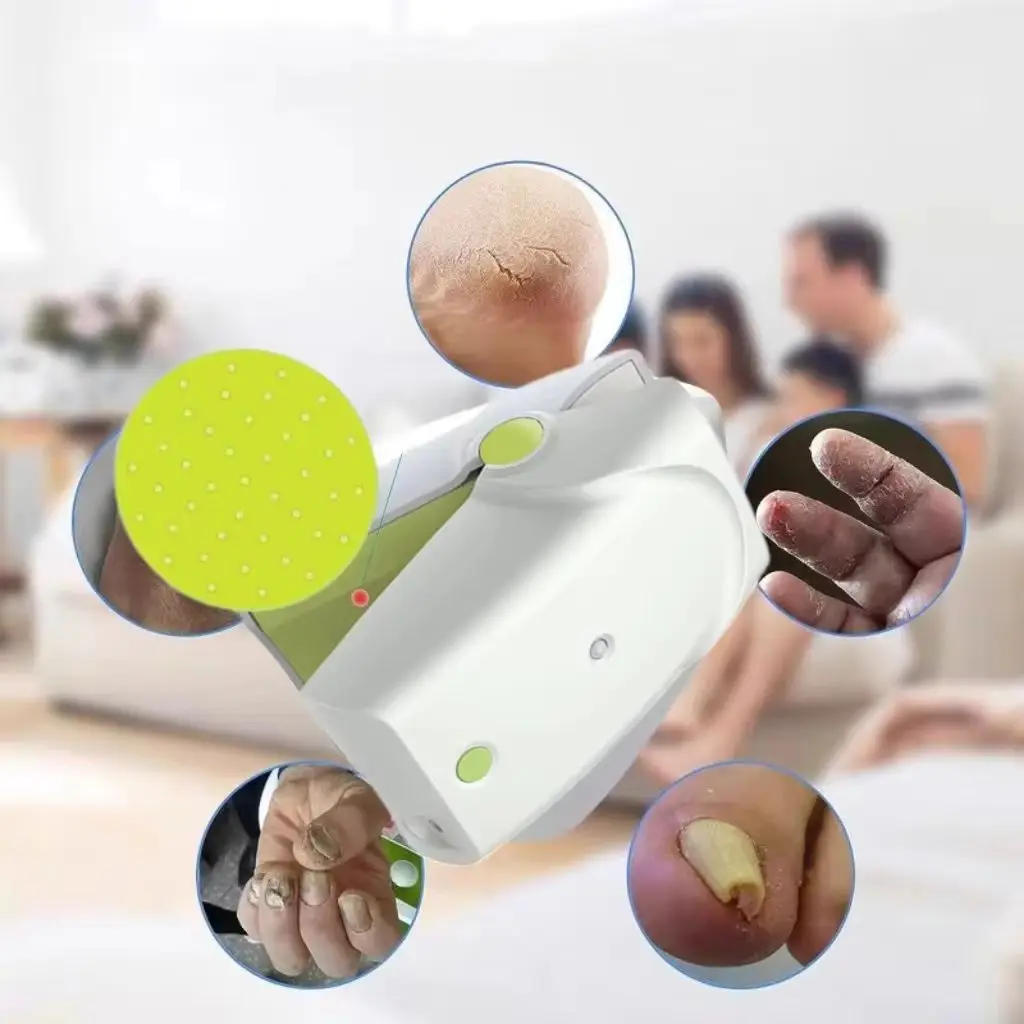 

Устройство для удаления грибка ногтей с двойной подсветкой, 470 нм, синий + лазер 905 нм для быстрого восстановления