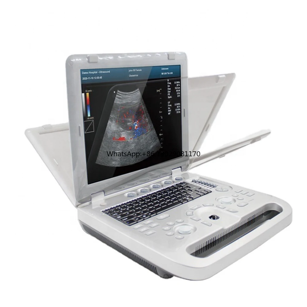 Portable ultrasound system  color Doppler ultrasonic diagnostic  ultrasound machine