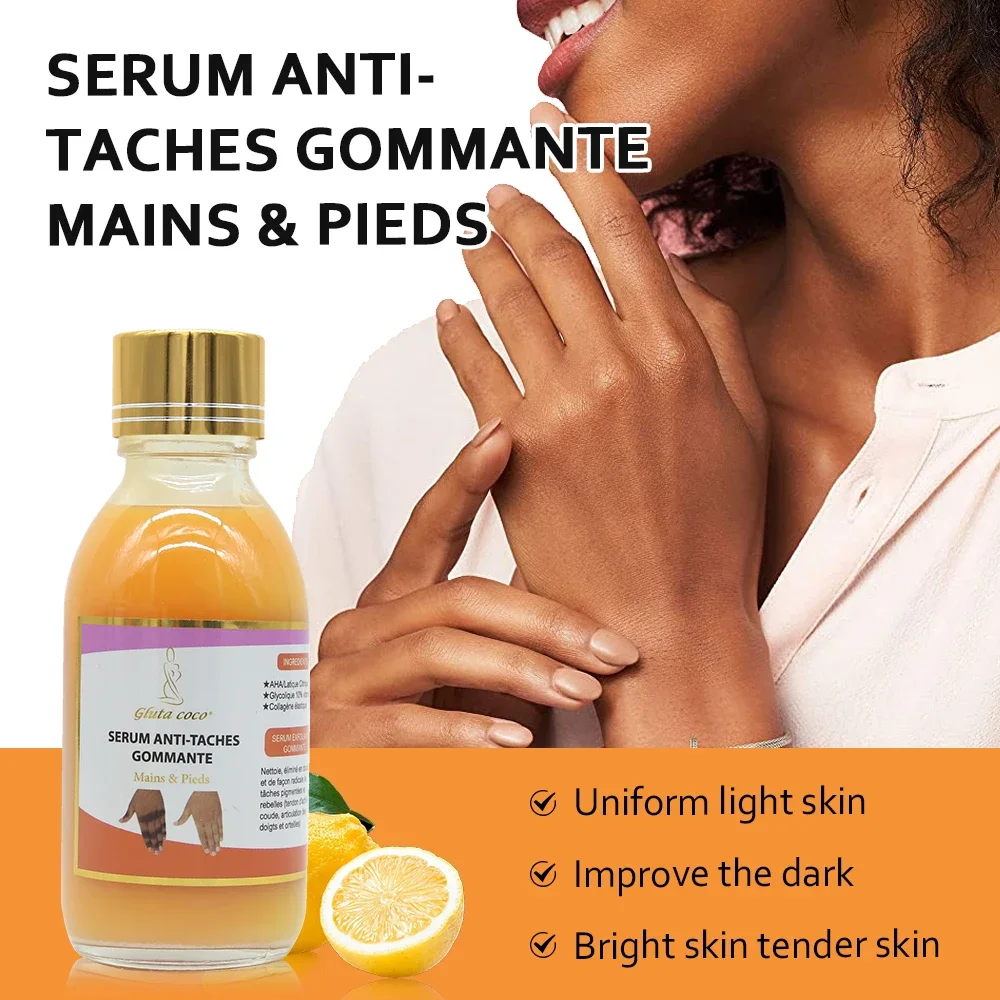 Orange Dark Spot Correcting Serum Whitening Skin Joints & Body Spot Removal Skin Care Skin Whitening Lotion For Joints