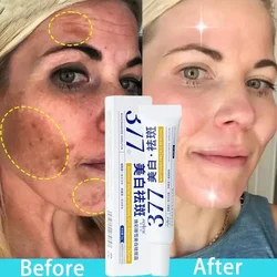 Creme De Sarda De Clareamento Eficaz, Fast Remove Melasma Dark Spots, Desvanecer-se a pigmentação da melanina, Anti-envelhecimento