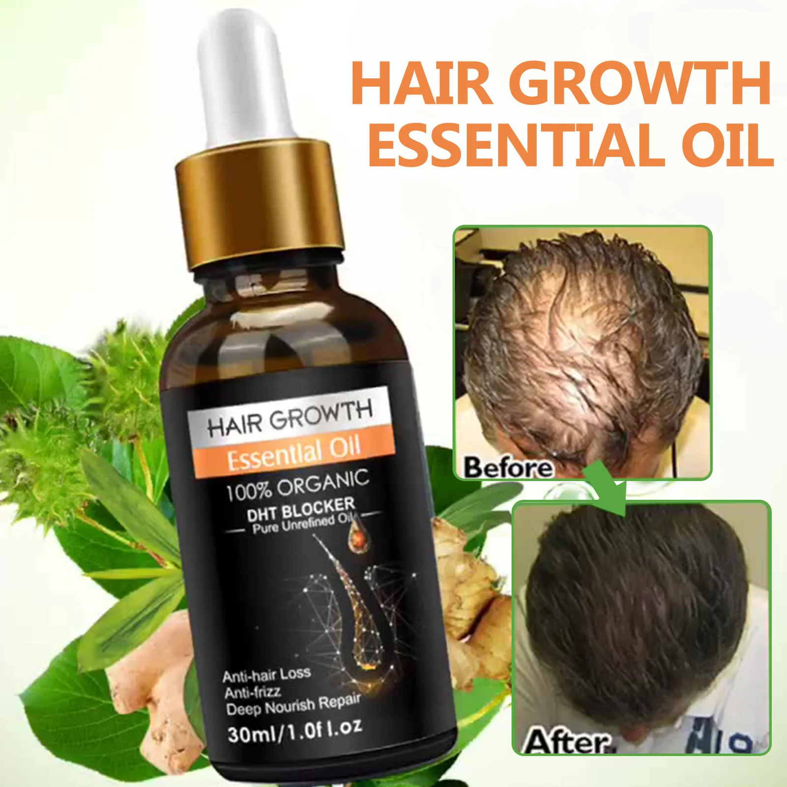 

Ginger Hair Growth Essential Oil Natural Herbal Cold-Pressed DHT Blocker And Hair Growth Shampoo Anti-Hair Loss Conditioner