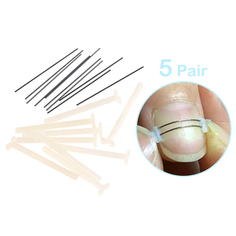 5Pairs Ingrown Toe Nail Treatment Ingrown Toenail Correction Tool Elastic Patch Sticker Straightening Clip Brace Pedicure Tool