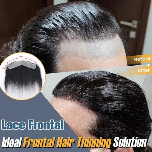 Imagen 2 del producto Peluquín Frontal para hombre con bucle en V, 100% cabello humano, parche de línea de cabello para la frente, piel fina de 0,06mm, línea de cabello de PU, prótesis capilar para hombres