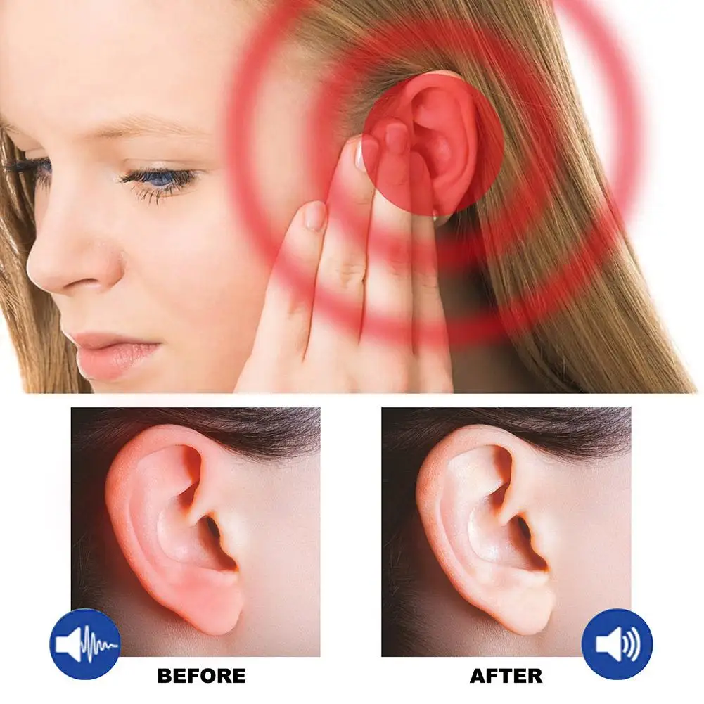 1 buah semprotan pereda Tinnitus Tinnitus tetesan penghilang telinga untuk berdering Tinnitus gatal Earache perawatan kesehatan anting 60 D1G6