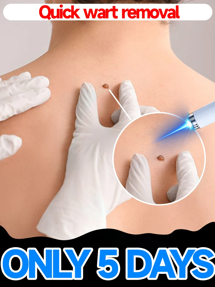 

3-секундная терапия для удаления бородавок подходит для любой части тела.