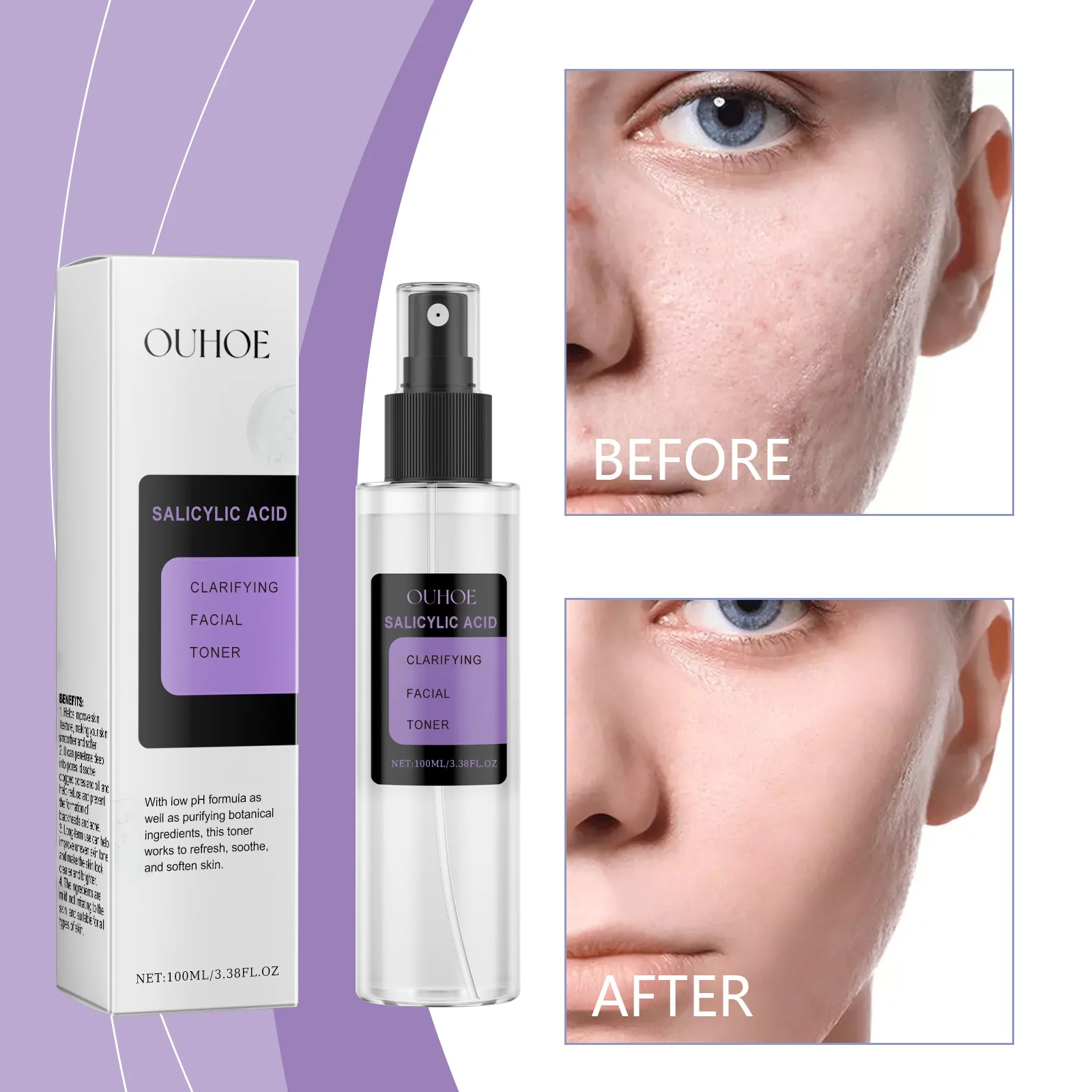 

OUHOE Salicylic Acid Moist Toner Hydrating and Softening Skin Firming and Tender Pore Balanced Oil Skin Care Water