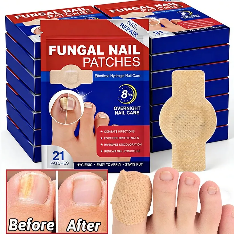 New Disposable Waterproof Toe Patch Nail Repair Patches Toenail Fungus Patch Sticky Toenail Care Nail Ingrown Correction Sticker