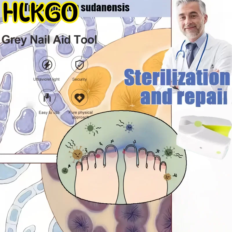 

USB перезаряжаемый лазер для грибка ногтей, длительный срок службы батареи для непрерывного лечения грибка ногтей на ногах