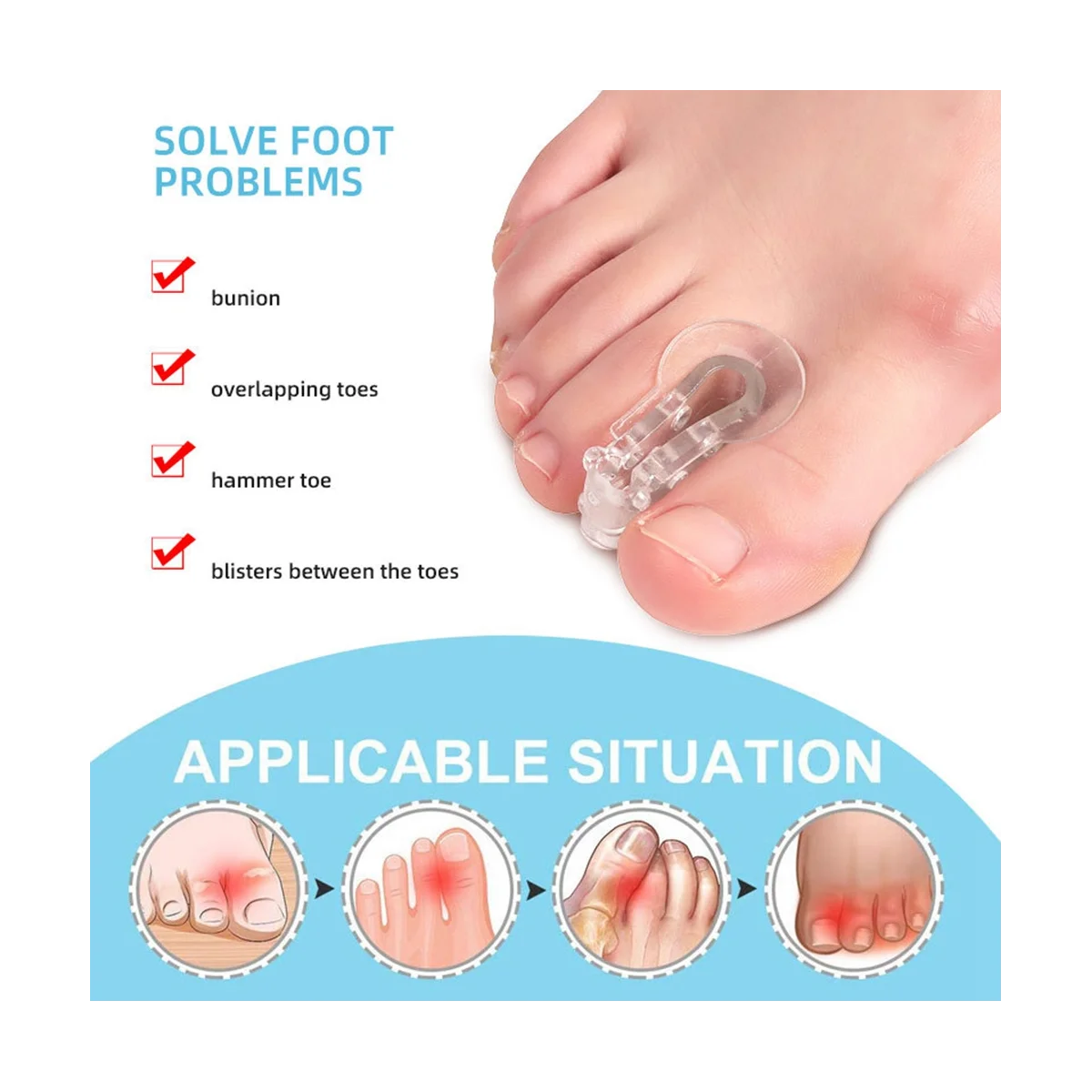 2 Stuks Teen Separator Voeten Zorg Beschermer Siliconen Teen Orthopedische Benodigdheden Bunion Corrector Hallux Valgus Voor Pedicure