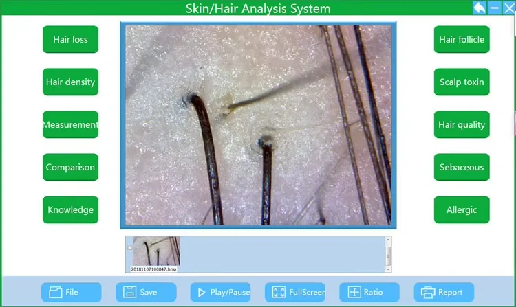 Professionelles digitales Mikroskop Elektronen-Dermatoskop Kopfhauterkennung Poren Lupe Gesichtshautanalysator Maschine Computergebrauch