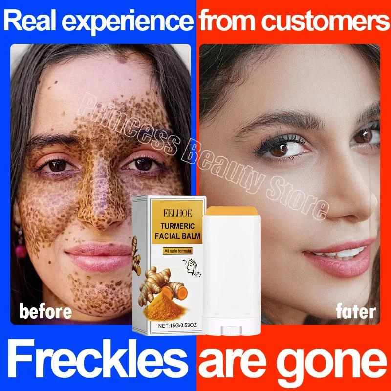 Whitening Freckle Multi Bounce Balm Facial Cream Dark Spot Remover Melanin Repair Anti-Aging Turmeric Stick Korean Cosmetics