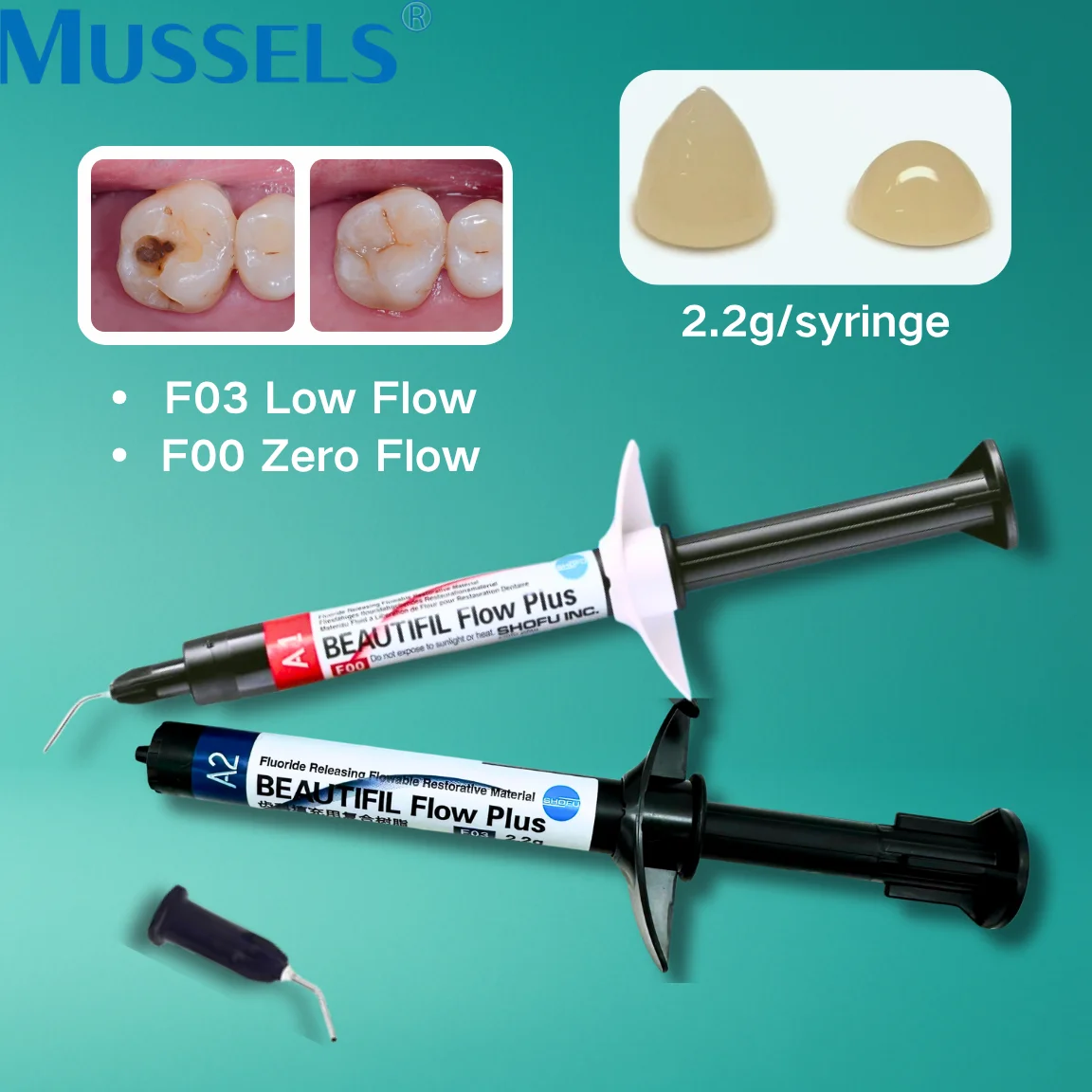 

2.2g/syringe Dental Fluid Resin Composite Low Flow Resina Teeth Restoration Filling Material Light Cure Adhesive Flowable Releas