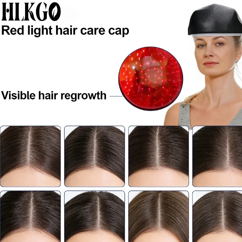 

Медицинский лазерный шлем с 96 диодами (красный свет, 650 нм) для терапии выпадения волос и стимуляции роста волос, для домашнего использования