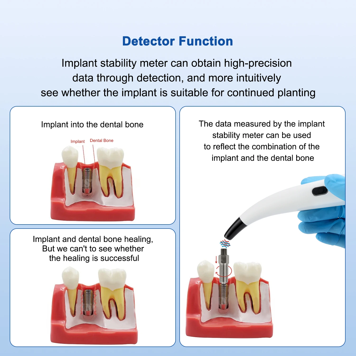 

Измеритель стабильности зубного имплантата AZDENT, тестер измерения Osseointegration, инструмент Osstell Beacon ISQ