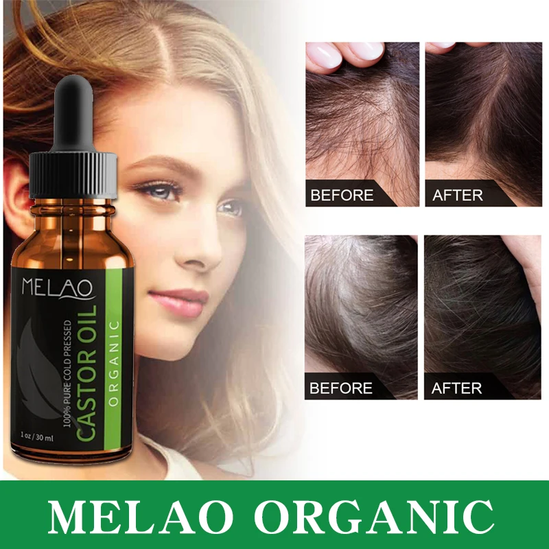 5Pcs 100% Castor Oil Hair Growth Eyelashes Eyebrows Hair Body Eyebrows Care Oil  Castor Oils Skin Moisturize 30ML No Box