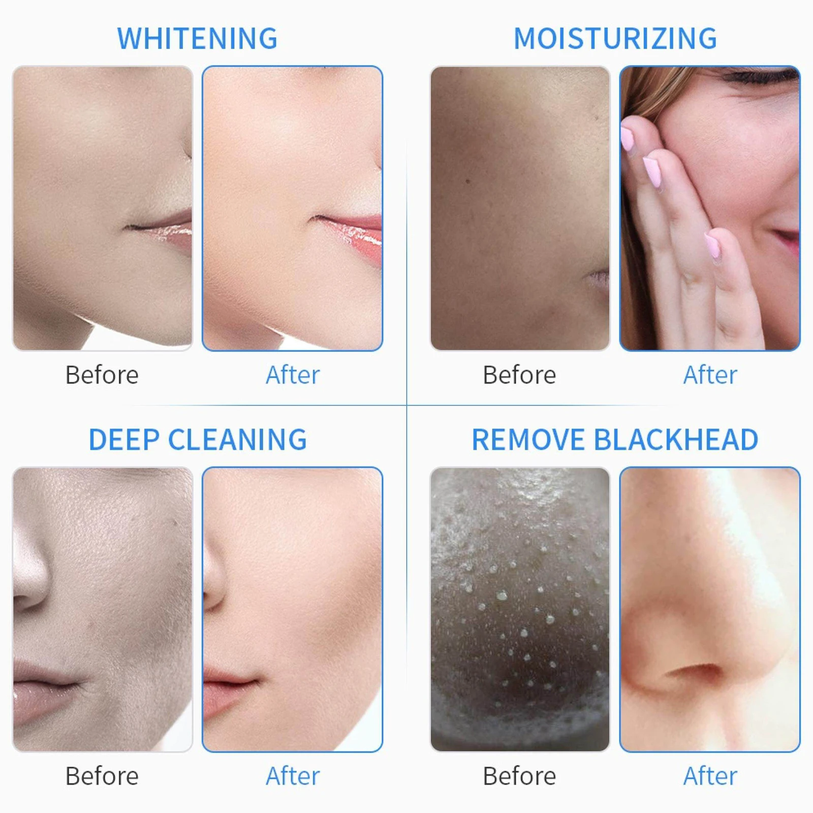 Hydra Dermabrasion Facial Machine Microdermabrasion Wrinkle Remover Aqua Peel Deep Cleaning Skin Tightening Device for Beauty Tr view 5