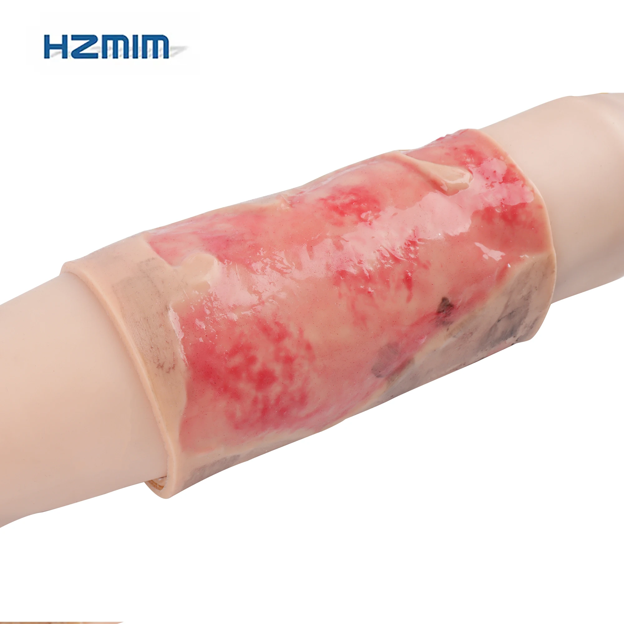 Advanced Burn Of The Limb Module Trauma Wound Silicone For Nurse Training Wound Model For Medical School