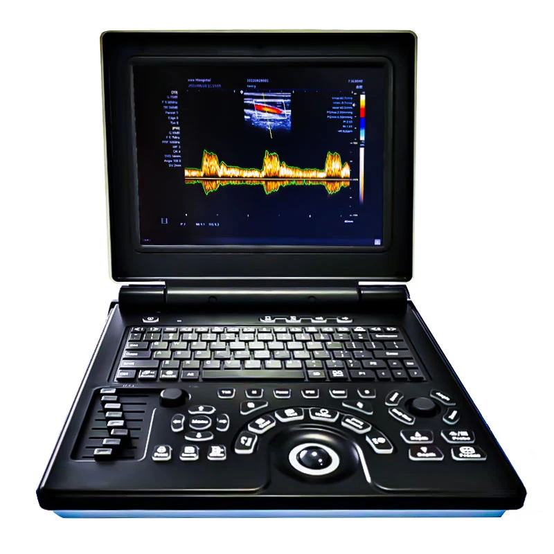 Veterinary Color 3D Doppler Ultrasonic Diagnostic System Vet Dedicated Software for Animal Vet Clinic