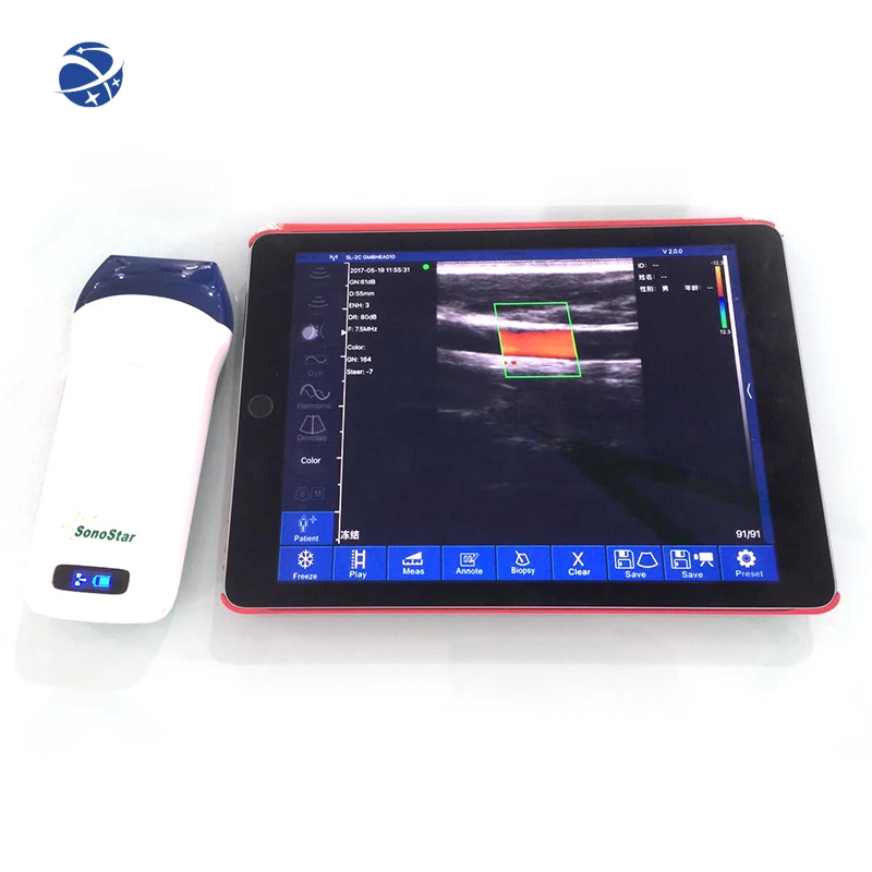 Wireless Doppler Ultrasound Probe 7.5 MHZ Corgi Digital Portable PW Sonar 128 Elements Scanner Linear Probe WIFI Android ISO