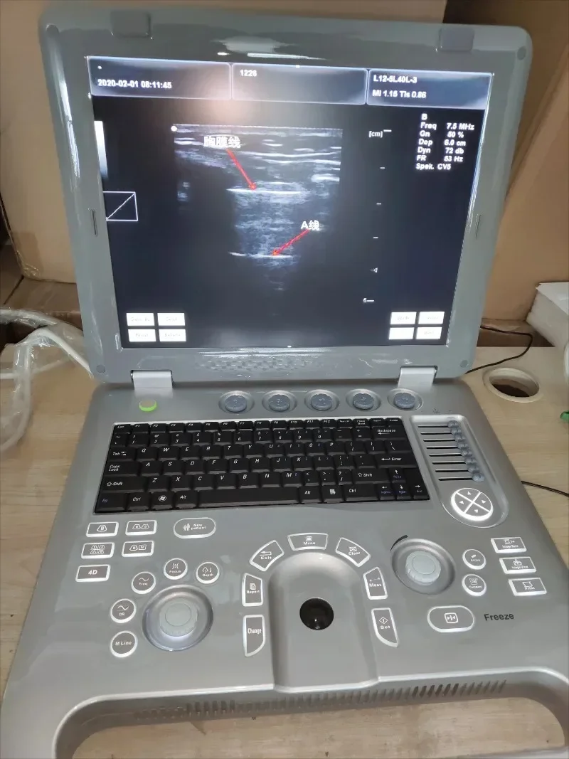 SUN-800D  Cheapest Digital Portable Ecografo Ultrasonido Portatil Discount Price Laptop 3D OB GYN Ultrasound Machine