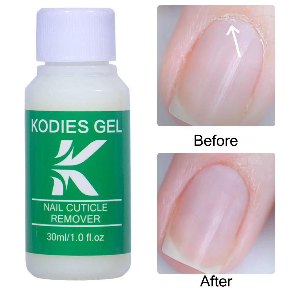 KODIES-GEL profesional removedor de aceite para cutículas, 30ML, líquido suavizante para uñas, tratamiento saludable para uñas, Kit de reparación para el cuidado de los pies