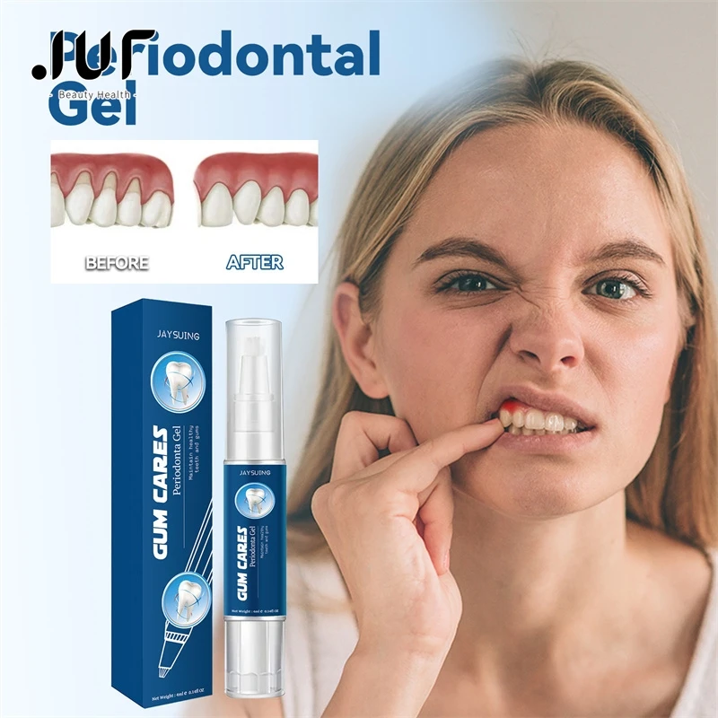 

Dental Teeth Whitening Gel Gum Care Gel For Deep Cleaning Of Dental Stains, Tartar, Swelling And Pain, Oral Hygiene Care