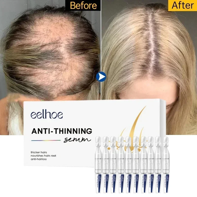 

10 pieces of hair follicle repair hair growth serum Fast anti-hair loss powerful nourishes nutritious hair root regeneration