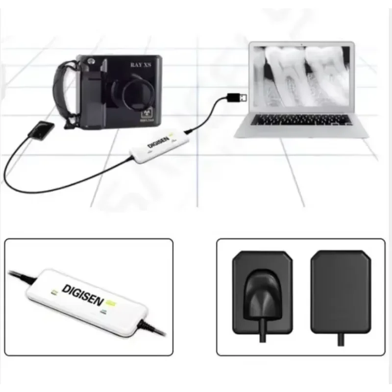 2026 2025rvg mini portable intra oral x ray sensor