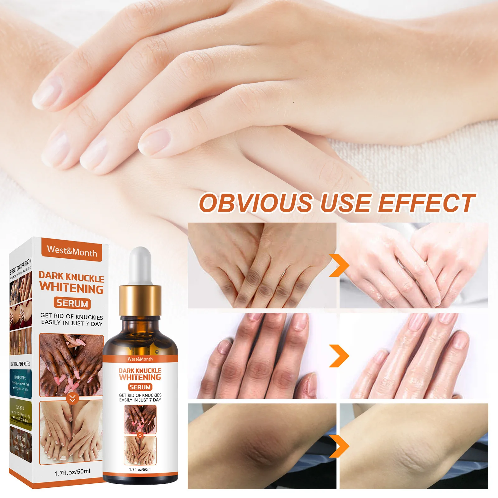 Dark Knuckles Lightening Serum Hand Knuckle Elbows Knee Lighten Oil Intense Stains Remover Products Beauty Care 50ml