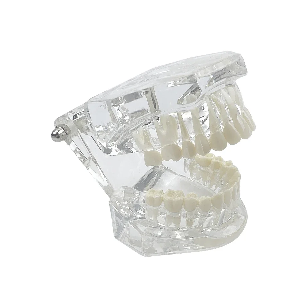 Normal Dental Model Teeth Dental Teaching Model Transparent Blue Pink Dentistry Adult Teeth Model For Studying Education Display