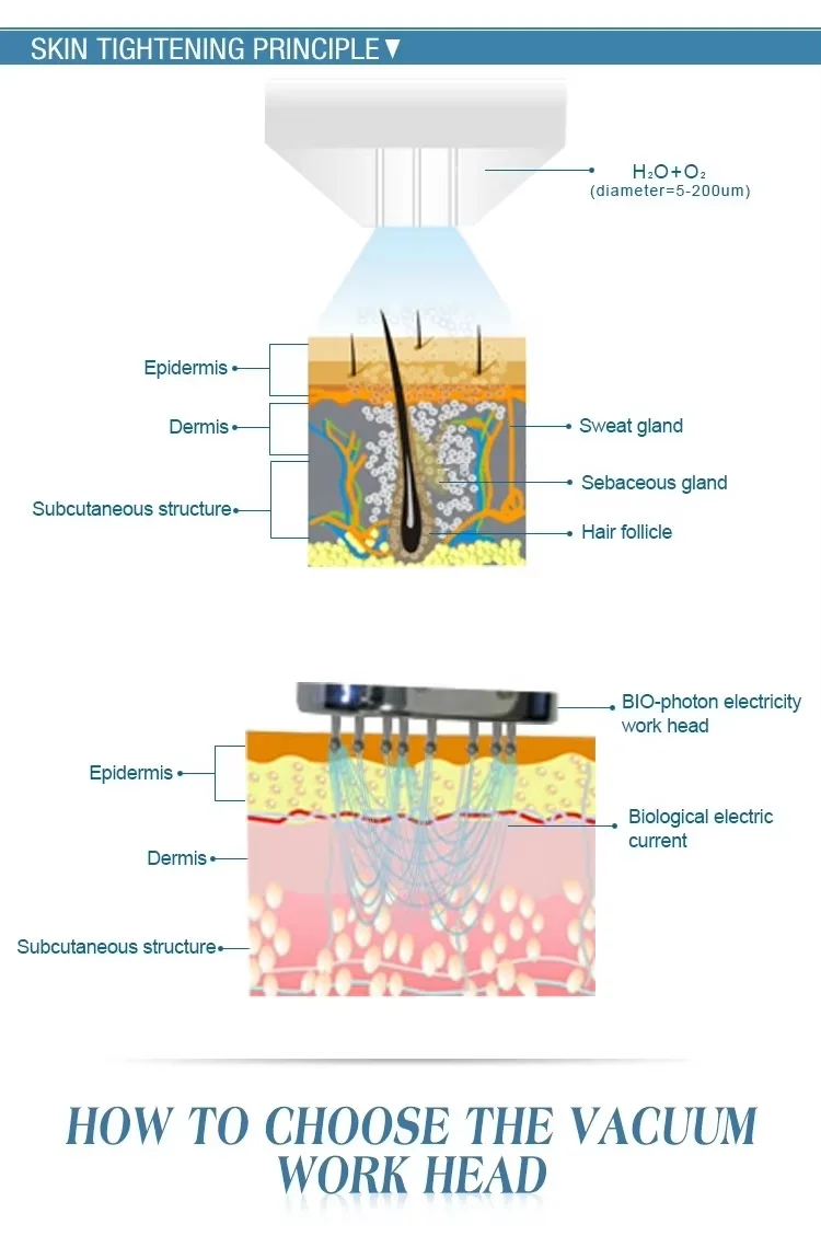 Máquina portátil y de alta presión para el cuidado facial con exfoliación por chorro de oxígeno No hay revisiones pero