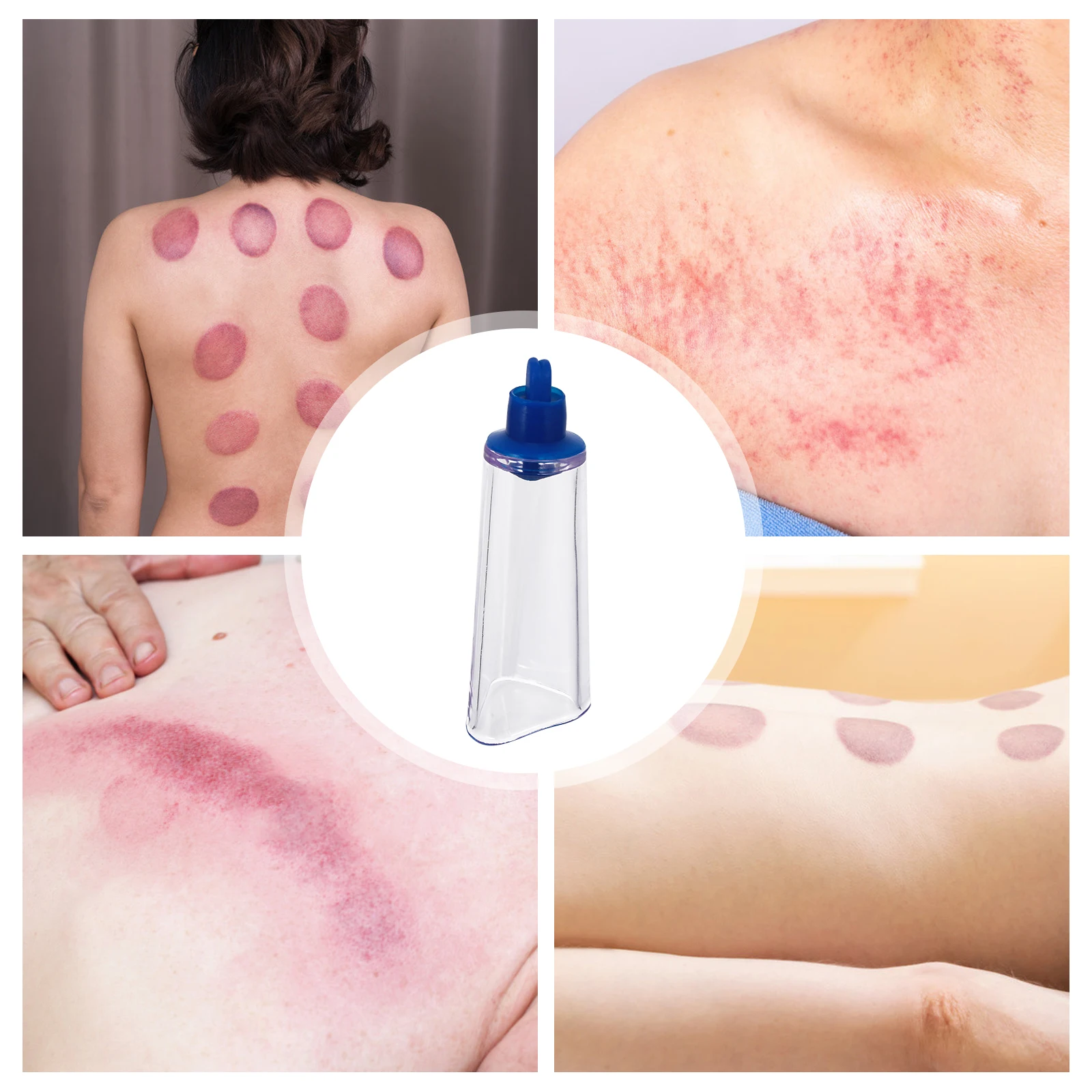 

2 pcs Plastic Vacuum Cupping Tools Durable Suction Massage Cups For Back Meridian Blood Circulation Traditional Chinese Therapy
